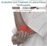 Evaluation and Treatment of Lateral Elbow Tendinopathy